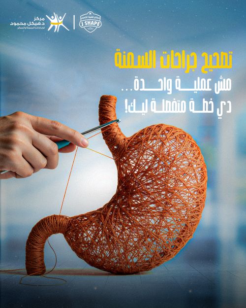 علامات فشل عملية التكميم